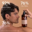Kép 7/7 - APIVITA Sampon ECO  száraz korpa ellen 500 ml