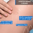 Kép 4/7 - Uriage Bariéderm stria olaj 100ml