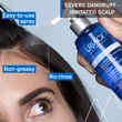 Kép 2/3 - Uriage D.S. Lotion Spray Korpás Fejbőrre 100 ml