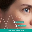 Kép 3/4 - Uriage HYSÉAC Szárító gél pattanások SOS kezelésére 15ml